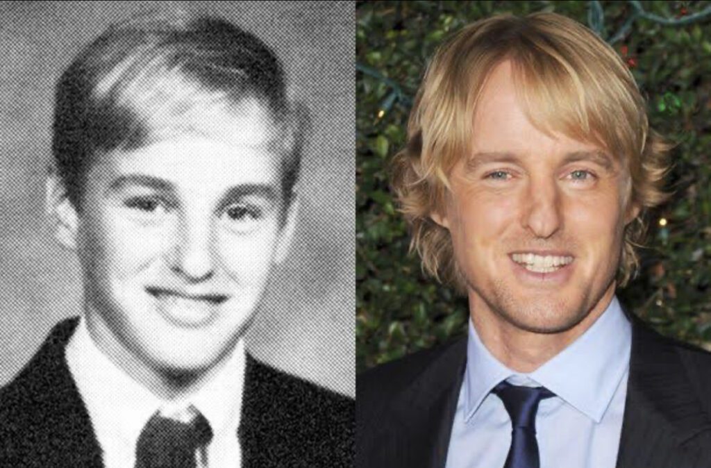 What Happened to Owen Wilson's Nose